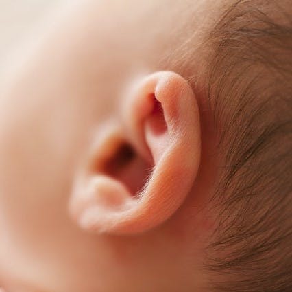 Intervento orecchie a sventola per bambini: quello che devi sapere