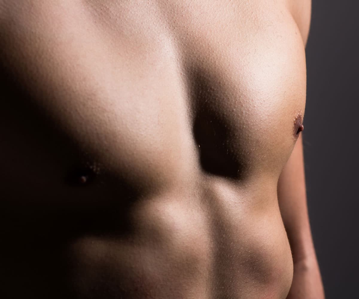 Introduction to Gynecomastia Surgery