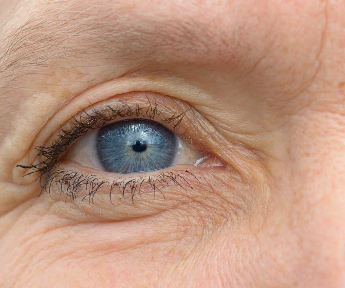Introduction to Eyelid Surgery