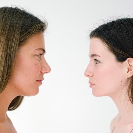 Cosmetic nose surgery: how does Rhinoplasty work