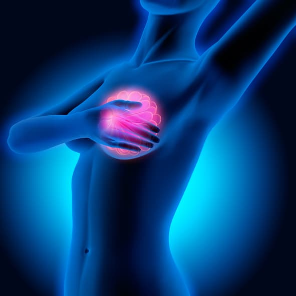 Intervento di Mastoplastica e Seno Tuberoso: ciò che devi sapere.