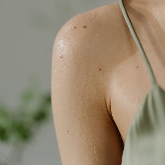 Botox per la sudorazione eccessiva: in cosa consiste?
