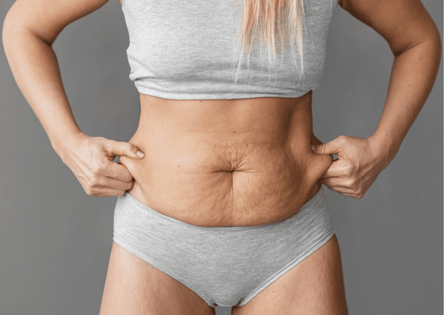 Addome flaccido dopo dimagrimento: quando serve l’addominoplastica