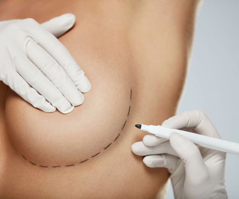 Download the before-and-after brochure of Dr. Zaccheddu's plastic and aesthetic surgery procedures.